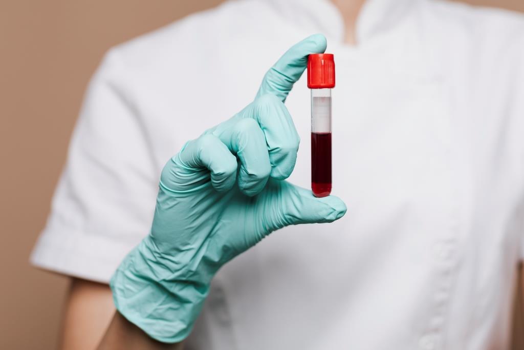 Lab Test